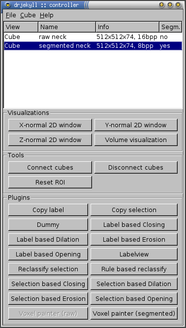 Controller widget